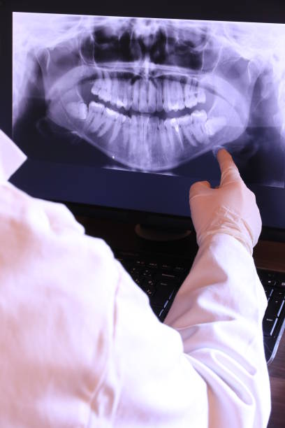 Best Chipped Tooth Repair Near Me  in Roanoke Rapids, NC