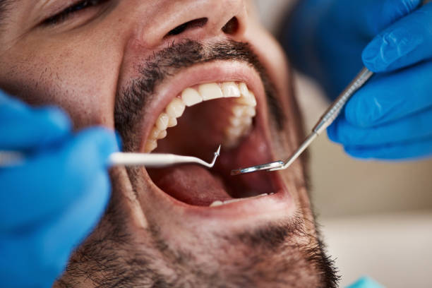 Best Cracked Tooth Emergency Dentist  in Roanoke Rapids, NC